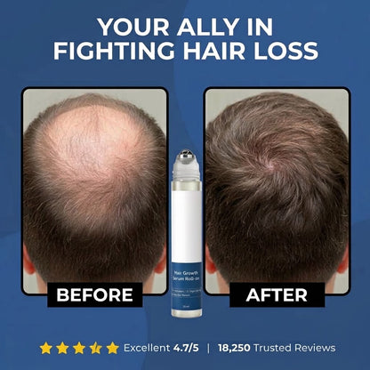 DermoStrand Hair Growth Roll on Serum